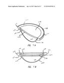 METHOD AND SYSTEM FOR ADJUSTING THE REFRACTIVE POWER OF AN IMPLANTED     INTRAOCULAR LENS diagram and image