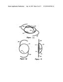 METHOD AND SYSTEM FOR ADJUSTING THE REFRACTIVE POWER OF AN IMPLANTED     INTRAOCULAR LENS diagram and image