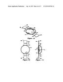 METHOD AND SYSTEM FOR ADJUSTING THE REFRACTIVE POWER OF AN IMPLANTED     INTRAOCULAR LENS diagram and image