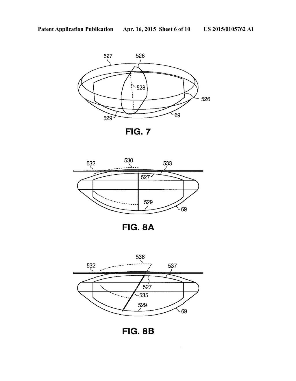 METHOD FOR PATTERNED PLASMA-MEDIATED MODIFICATION OF THE CRYSTALLINE LENS - diagram, schematic, and image 07