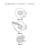 METHOD FOR PATTERNED PLASMA-MEDIATED MODIFICATION OF THE CRYSTALLINE LENS diagram and image