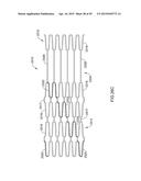 DEVICES AND METHODS FOR NERVE MODULATION diagram and image