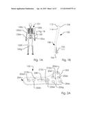 Combined Intramedullary and Extramedullary Surgical Aiming System And     Method diagram and image