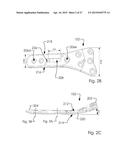 Combined Intramedullary and Extramedullary Surgical Aiming System And     Method diagram and image