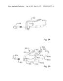 Combined Intramedullary and Extramedullary Surgical Aiming System And     Method diagram and image