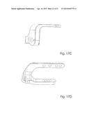 Combined Intramedullary and Extramedullary Surgical Aiming System And     Method diagram and image