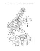 SURGICAL STAPLING DEVICE diagram and image