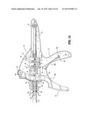 SURGICAL STAPLING DEVICE diagram and image