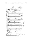 SURGICAL STAPLING DEVICE diagram and image