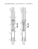 SURGICAL STAPLING DEVICE diagram and image