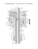 SURGICAL STAPLING DEVICE diagram and image