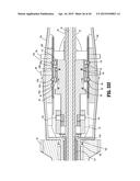 SURGICAL STAPLING DEVICE diagram and image