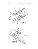 SURGICAL STAPLING DEVICE diagram and image