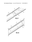 SURGICAL STAPLING DEVICE diagram and image