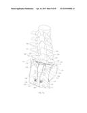 ADJUSTABLE SPINAL IMPLANT diagram and image