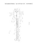 ADJUSTABLE SPINAL IMPLANT diagram and image