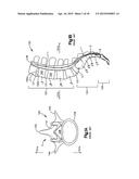 TIGHTENING DEVICE FOR SPINE SURGERY diagram and image