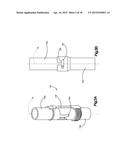 TIGHTENING DEVICE FOR SPINE SURGERY diagram and image