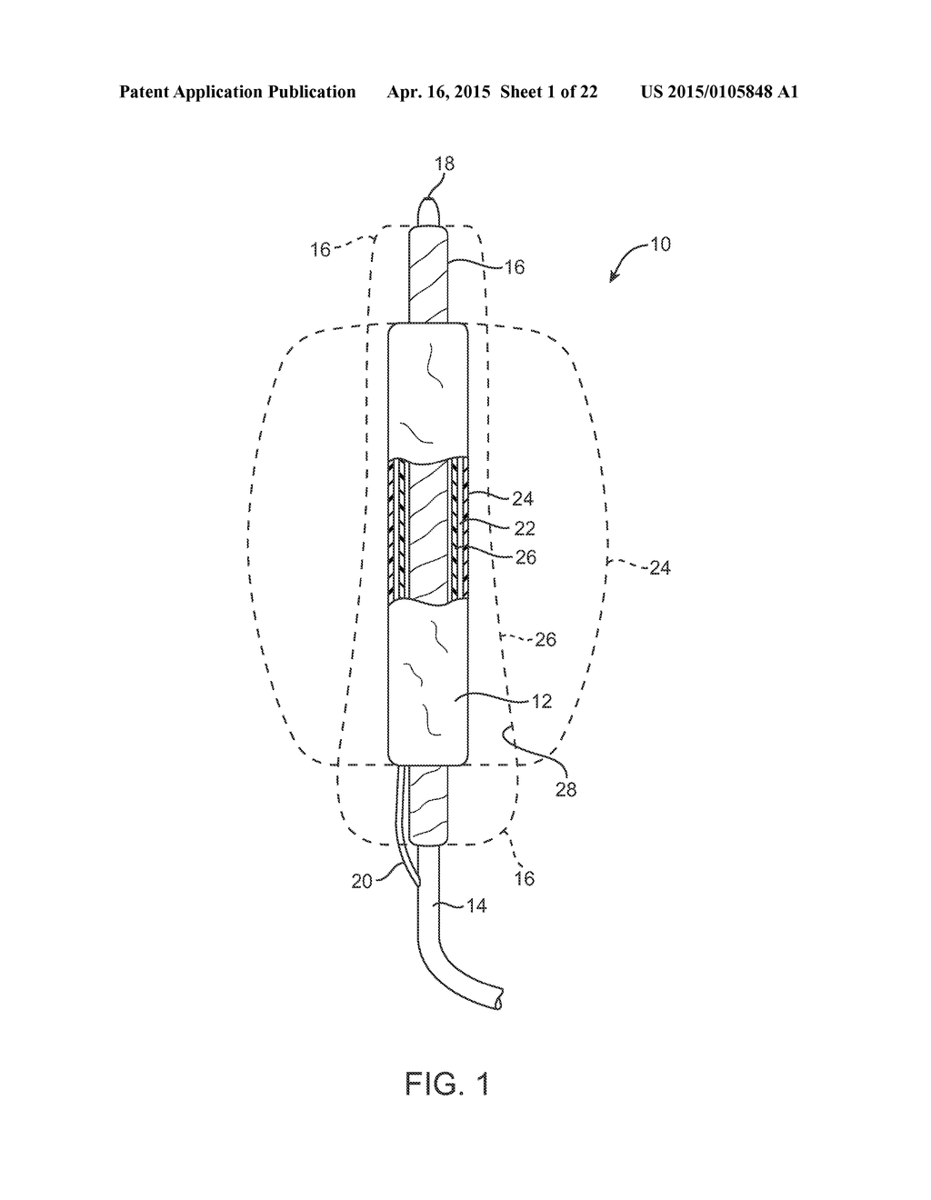 GRAFT SYSTEMS HAVING FILLING STRUCTURES SUPPORTED BY SCAFFOLDS AND METHODS     FOR THEIR USE - diagram, schematic, and image 02