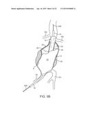 GRAFT SYSTEMS HAVING FILLING STRUCTURES SUPPORTED BY SCAFFOLDS AND METHODS     FOR THEIR USE diagram and image