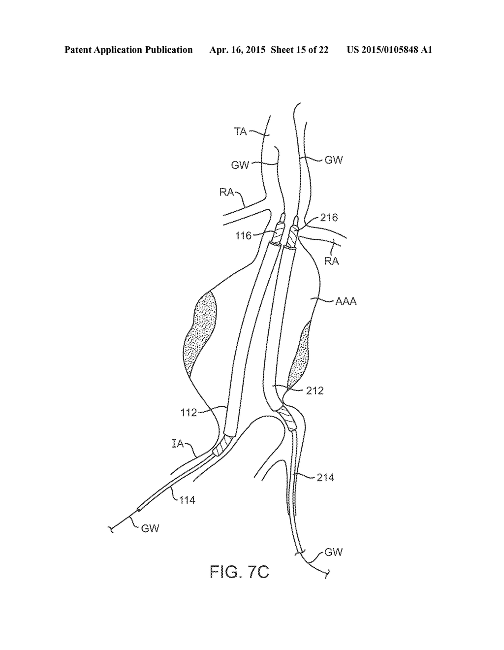 GRAFT SYSTEMS HAVING FILLING STRUCTURES SUPPORTED BY SCAFFOLDS AND METHODS     FOR THEIR USE - diagram, schematic, and image 16