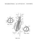 GRAFT SYSTEMS HAVING FILLING STRUCTURES SUPPORTED BY SCAFFOLDS AND METHODS     FOR THEIR USE diagram and image