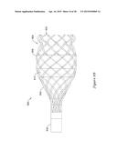 METHODS AND SYSTEMS FOR LOADING AND DELIVERING A STENT diagram and image