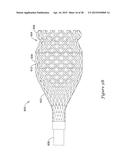 METHODS AND SYSTEMS FOR LOADING AND DELIVERING A STENT diagram and image