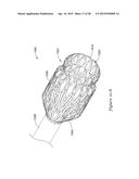 METHODS AND SYSTEMS FOR LOADING AND DELIVERING A STENT diagram and image