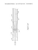 METHODS AND SYSTEMS FOR LOADING AND DELIVERING A STENT diagram and image