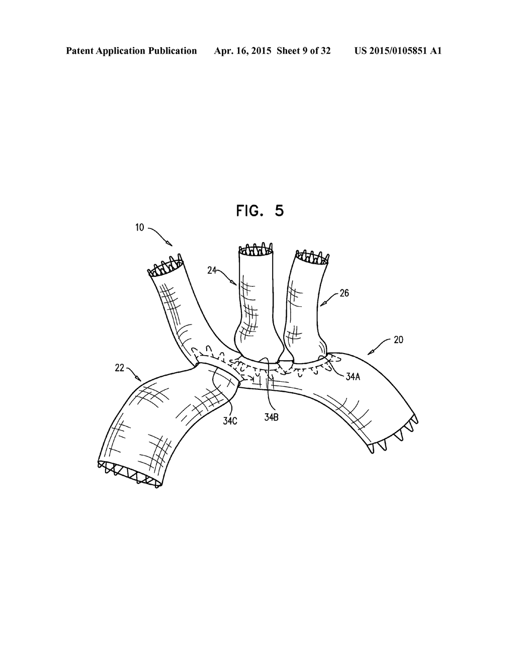 MULTI-COMPONENT STENT-GRAFT SYSTEM FOR IMPLANTATION IN A BLOOD VESSEL WITH     MULTIPLE BRANCHES - diagram, schematic, and image 10