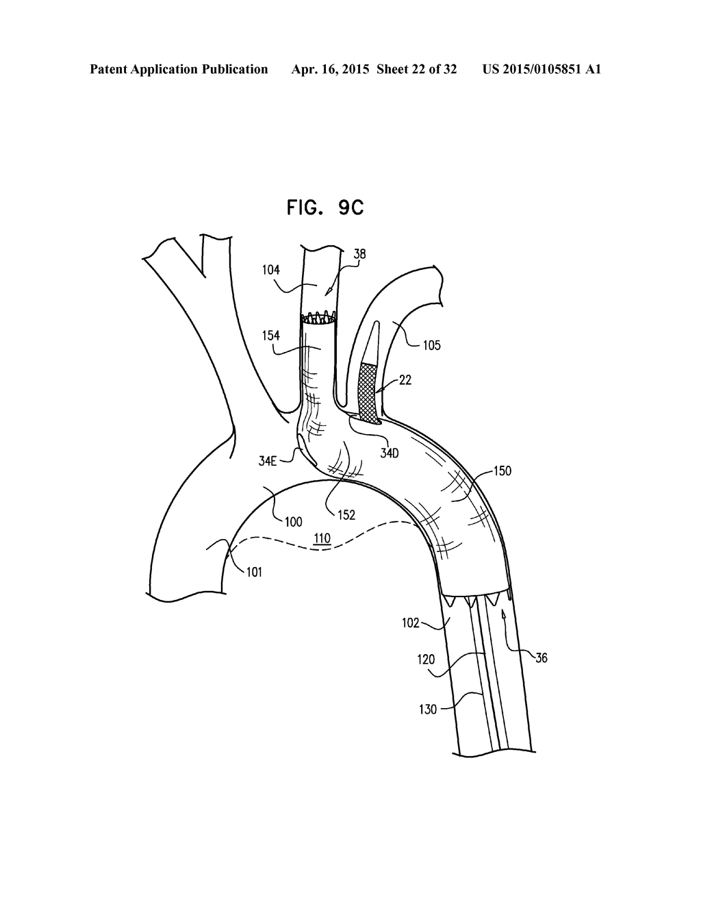 MULTI-COMPONENT STENT-GRAFT SYSTEM FOR IMPLANTATION IN A BLOOD VESSEL WITH     MULTIPLE BRANCHES - diagram, schematic, and image 23