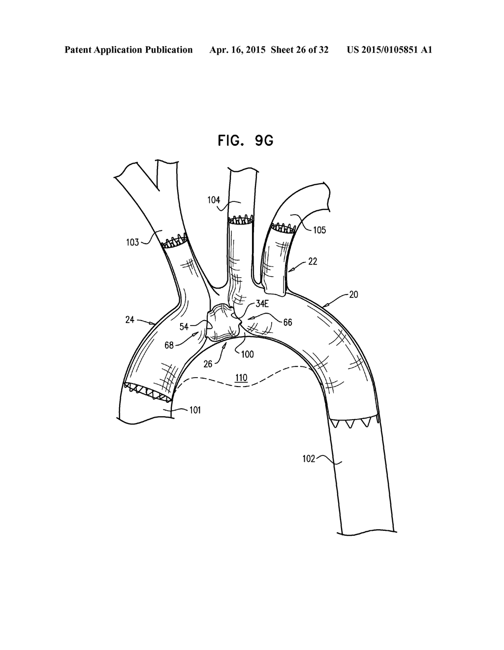 MULTI-COMPONENT STENT-GRAFT SYSTEM FOR IMPLANTATION IN A BLOOD VESSEL WITH     MULTIPLE BRANCHES - diagram, schematic, and image 27