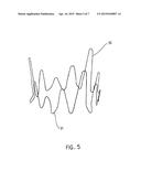 DEVICES USEFUL FOR IMPLANTATION AT A HEART VALVE diagram and image