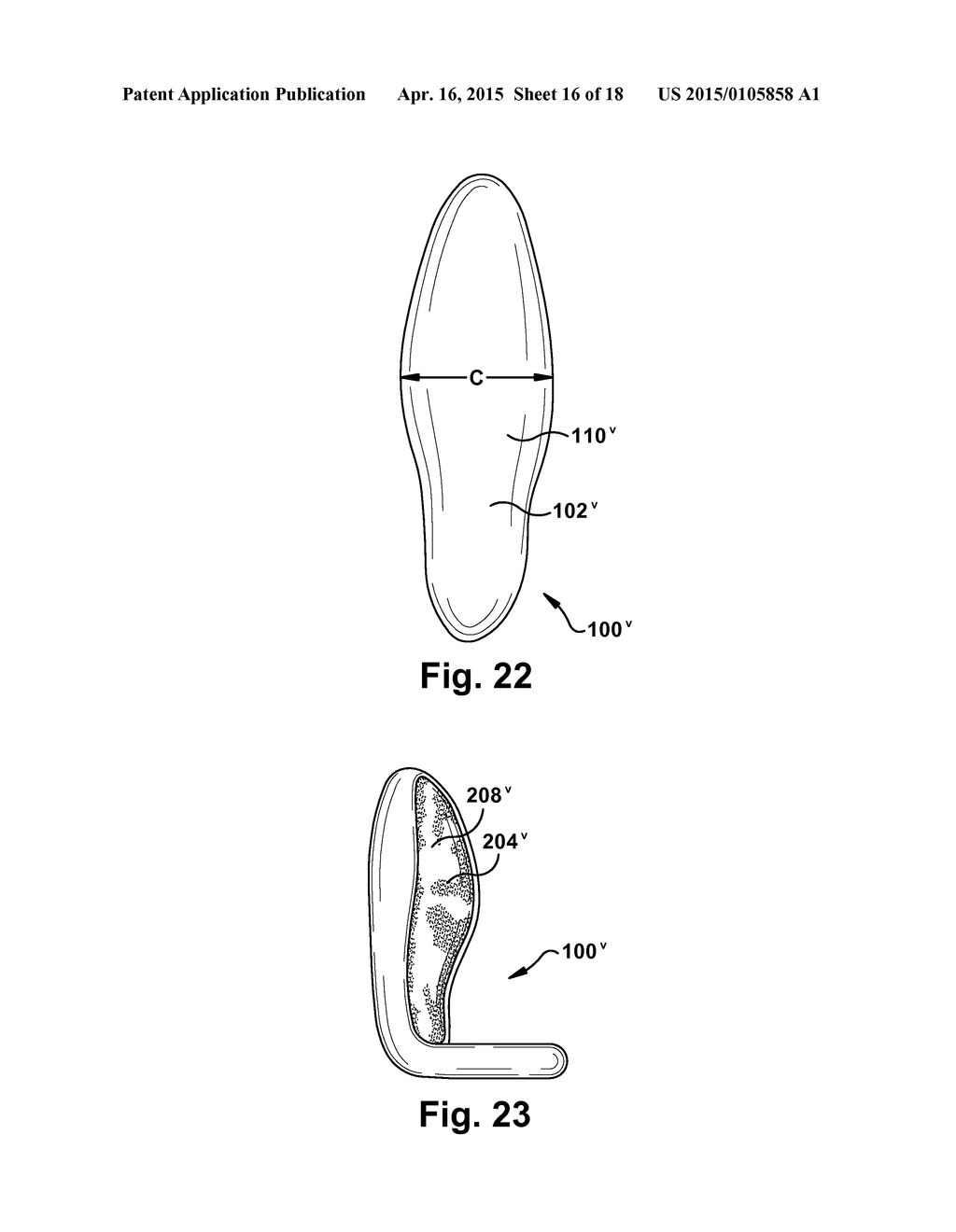 PROSTHETIC IMPLANTS - diagram, schematic, and image 17