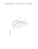 METHODS AND DEVICES FOR LESS INVASIVE GLENOID REPLACEMENT diagram and image