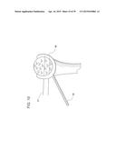 METHODS AND DEVICES FOR LESS INVASIVE GLENOID REPLACEMENT diagram and image