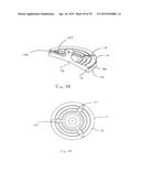 METHODS AND DEVICES FOR LESS INVASIVE GLENOID REPLACEMENT diagram and image