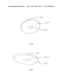 METHODS AND DEVICES FOR LESS INVASIVE GLENOID REPLACEMENT diagram and image