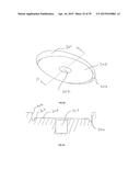 METHODS AND DEVICES FOR LESS INVASIVE GLENOID REPLACEMENT diagram and image