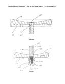 METHODS AND DEVICES FOR LESS INVASIVE GLENOID REPLACEMENT diagram and image