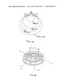 METHODS AND DEVICES FOR LESS INVASIVE GLENOID REPLACEMENT diagram and image