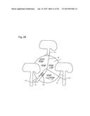 Device and Method for Tensioning and,or Securing a Material diagram and image