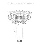 CASKET HARDWARE ATTACHMENT STRUCTURE diagram and image