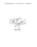 Dosage Valve for a Backflushing and Teat Dip Applicator System diagram and image