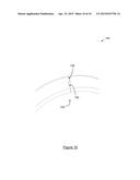 WEAR RING FOR DIE-CASTING PISTON, DIE-CASTING PISTON INCORPORATING SAME,     AND METHOD OF FORMING SAME diagram and image