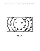 Apparatus for Pathogen Detection diagram and image