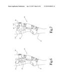 Knee Brace Holder diagram and image