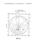 Process For Determining A Pair Of Progressive Ophthalmic Lenses diagram and image