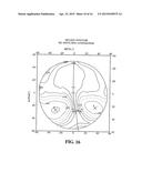 Process For Determining A Pair Of Progressive Ophthalmic Lenses diagram and image